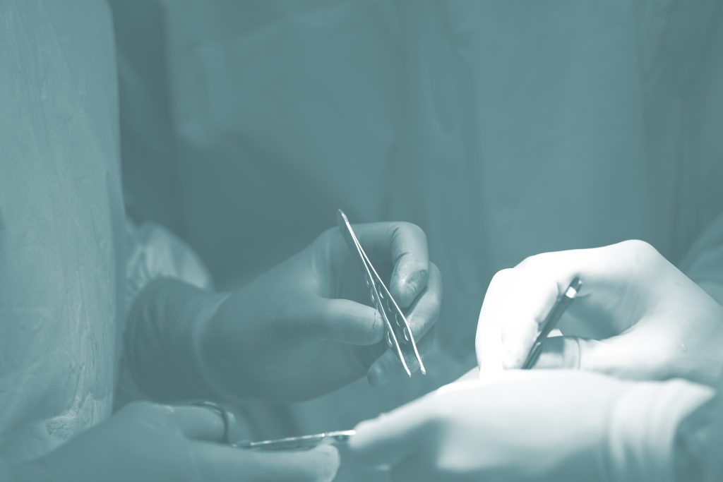 THE SECONDARY CHALLENG